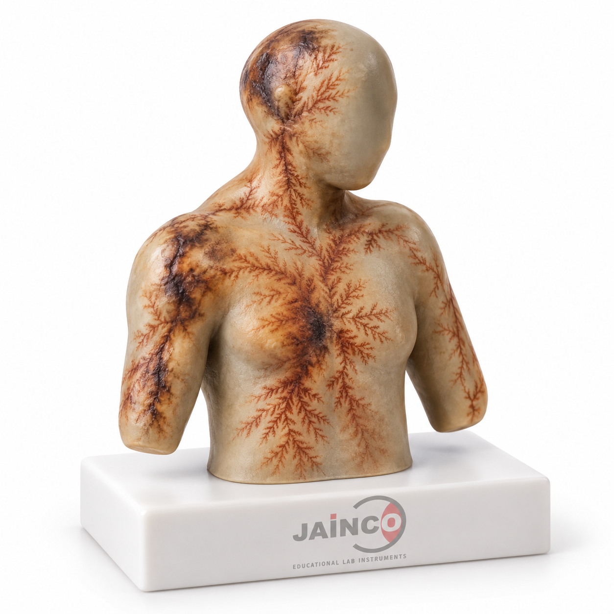 Lightening Injuries Model